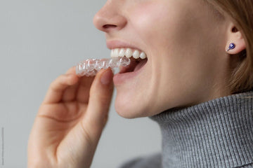 How Much Does Teeth Whitening Cost?