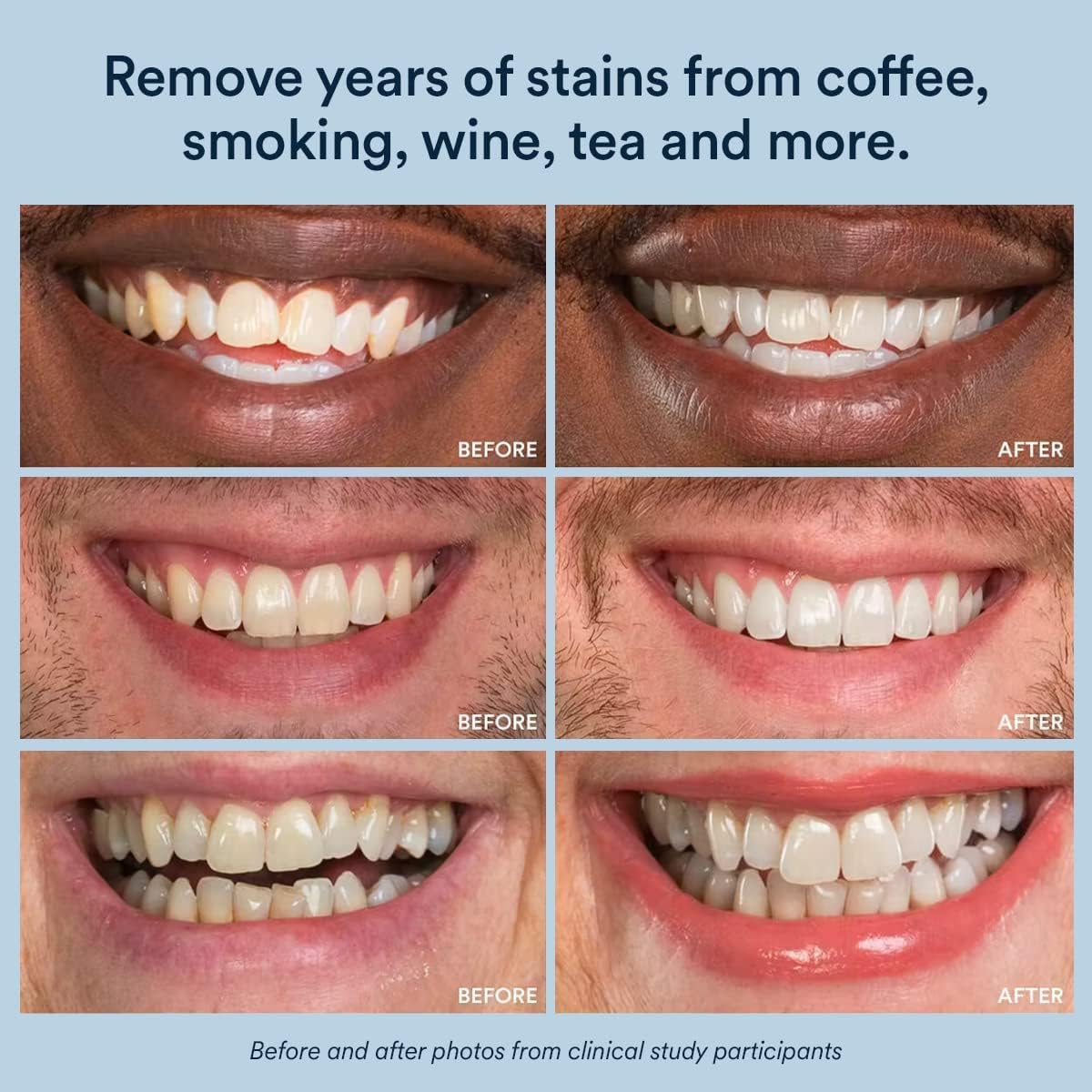 Auraglow Whitening Gel Toothpaste Booster